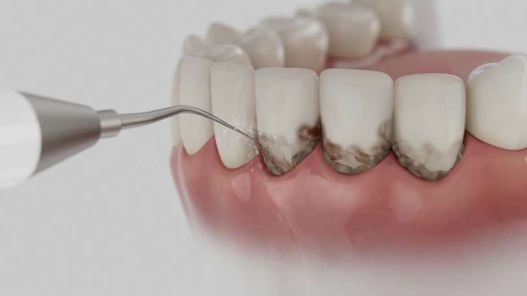 Reliable Dental contractor in Mikes, TX by Smile Center Dentistry